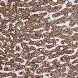 DECR1 Antibody, Novus Biologicals 0.1mL; Unlabeled:Antibodies, Polyclonal