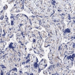 DECR1 Antibody, Novus Biologicals 0.1mL; Unlabeled:Antibodies, Polyclonal