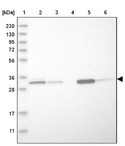 DECR1 Antibody, Novus Biologicals 0.1mL; Unlabeled:Antibodies, Polyclonal