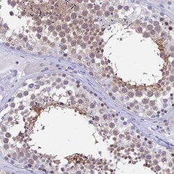 DEFB107A Antibody, Novus Biologicals 100uL; Unlabeled:Antibodies, Polyclonal