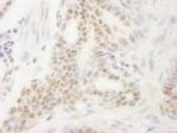 DEK Antibody, Novus Biologicals 0.1mg; Unlabeled:Antibodies, Polyclonal