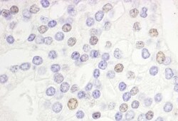 DEK Antibody, Novus Biologicals 0.1mg; Unlabeled:Antibodies, Polyclonal