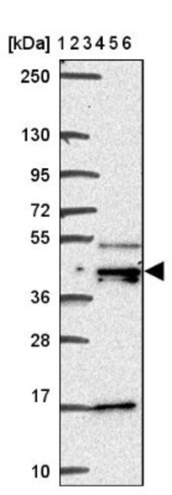 DEK Antibody, Novus Biologicals:Antibodies:Primary Antibodies