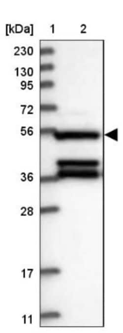 DELGEF Antibody, Novus Biologicals 25 μL; Unlabeled:Antibodies, Polyclonal