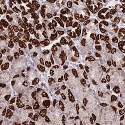 DENN/MADD Domain Containing 2D Antibody, Novus Biologicals:Antibodies:Primary
