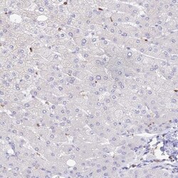 DENND1C Antibody, Novus Biologicals:Antibodies:Primary Antibodies