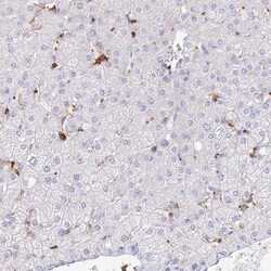 DENND1C Antibody, Novus Biologicals:Antibodies:Primary Antibodies