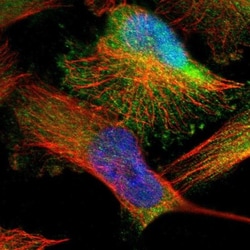 DENND4C Antibody, Novus Biologicals 0.1mL; Unlabeled:Antibodies, Polyclonal