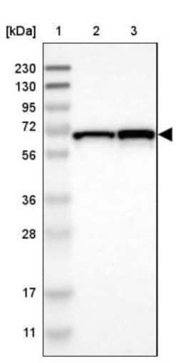 DENND4C Antibody, Novus Biologicals 0.1mL; Unlabeled:Antibodies, Polyclonal