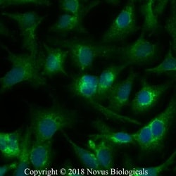 DGAT1 Antibody - BSA Free, Novus Biologicals 0.1mL; Unlabeled:Antibodies,