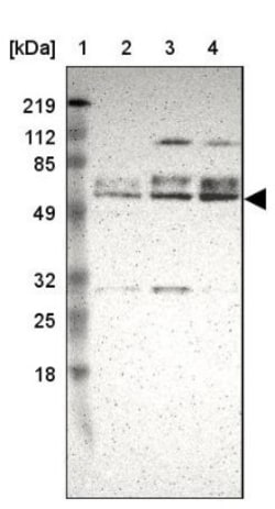 DGCR14 Antibody, Novus Biologicals 0.1mL; Unlabeled:Antibodies, Polyclonal