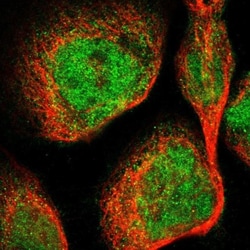 DGK-epsilon Antibody, Novus Biologicals 0.1mL; Unlabeled:Antibodies, Polyclonal
