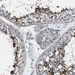 DGK-epsilon Antibody, Novus Biologicals 0.1mL; Unlabeled:Antibodies, Polyclonal