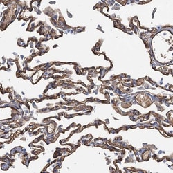 DGK-gamma Antibody, Novus Biologicals 25 &mu;L; Unlabeled:Antibodies, Polyclonal