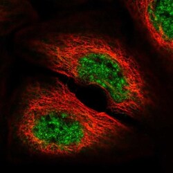 DGK-zeta Antibody, Novus Biologicals:Antibodies:Primary Antibodies