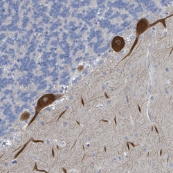 DGK-zeta Antibody, Novus Biologicals:Antibodies:Primary Antibodies