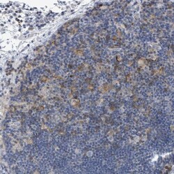 DGK-zeta Antibody, Novus Biologicals:Antibodies:Primary Antibodies