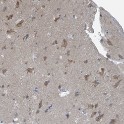 DGK-zeta Antibody, Novus Biologicals:Antibodies:Primary Antibodies