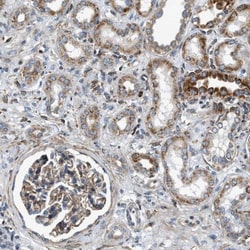 DHODH Antibody, Novus Biologicals:Antibodies:Primary Antibodies