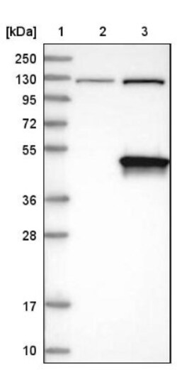 DHPS Antibody, Novus Biologicals 0.1mL; Unlabeled:Antibodies, Polyclonal