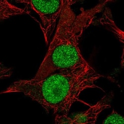 DHRS12 Antibody, Novus Biologicals 25 &mu;L, Unlabeled:Antibodies, Polyclonal