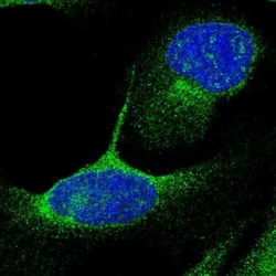 DHRS13 Antibody, Novus Biologicals 0.1mL; Unlabeled:Antibodies, Polyclonal