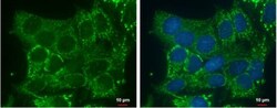 DHRS2 Antibody, Novus Biologicals 0.1mL; Unlabeled:Antibodies, Polyclonal