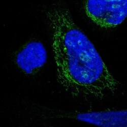 DHRS3 Antibody, Novus Biologicals 25 &mu;L; Unlabeled:Antibodies, Polyclonal
