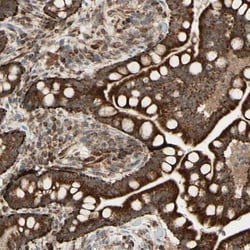 DHRS3 Antibody, Novus Biologicals 25 &mu;L; Unlabeled:Antibodies, Polyclonal