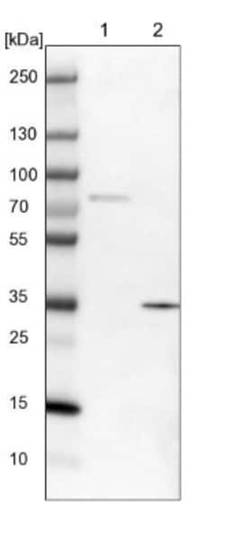 DHRS7 Antibody, Novus Biologicals:Antibodies:Primary Antibodies