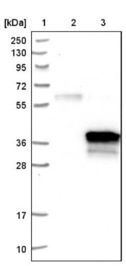DHRS7B Antibody, Novus Biologicals 25 &mu;L | Buy Online | Novus Biologicals | Fisher Scientific