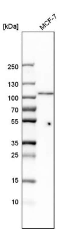 DHTKD1 Antibody, Novus Biologicals:Antibodies:Primary Antibodies