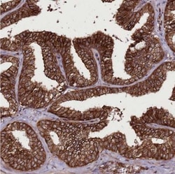 DHX29 Antibody, Novus Biologicals 0.1mL; Unlabeled:Antibodies, Polyclonal