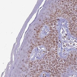 DHX37 Antibody, Novus Biologicals 25 &mu;L, Unlabeled:Antibodies, Polyclonal