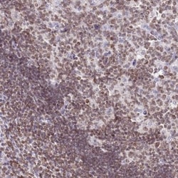 DHX37 Antibody, Novus Biologicals 25 &mu;L, Unlabeled:Antibodies, Polyclonal