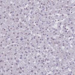 DHX37 Antibody, Novus Biologicals 25 &mu;L, Unlabeled:Antibodies, Polyclonal