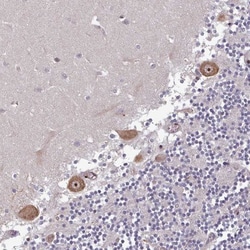 DHX8 Antibody, Novus Biologicals:Antibodies:Primary Antibodies