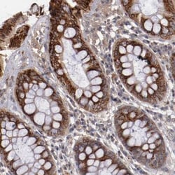 DIA1R Antibody, Novus Biologicals:Antibodies:Primary Antibodies