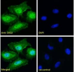 DIO2 Antibody, Novus Biologicals 0.1mg; Unlabeled:Antibodies, Polyclonal