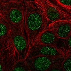 DIP2A Antibody, Novus Biologicals:Antibodies:Primary Antibodies