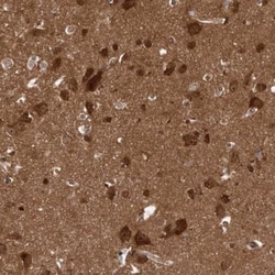 DIP2C Antibody, Novus Biologicals 0.1mL; Unlabeled:Antibodies, Polyclonal