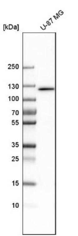 DIS3 Antibody, Novus Biologicals 25 &mu;L; Unlabeled:Anticorps, Polyclonal