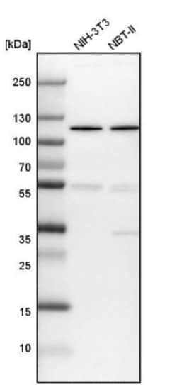 DIS3 Antibody, Novus Biologicals 25 &mu;L; Unlabeled:Anticorps, Polyclonal