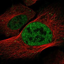 DISP2 Antibody, Novus Biologicals:Antibodies:Primary Antibodies