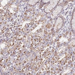 DISP2 Antibody, Novus Biologicals:Antibodies:Primary Antibodies