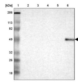 DKC1 Antibody, Novus Biologicals 0.1mL; Unlabeled:Antibodies, Polyclonal