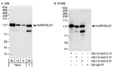 DLG7/HURP Antibody, Novus Biologicals 0.1 mL | Buy Online | Novus Biologicals | Fisher Scientific