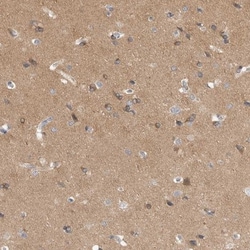 DLGAP3 Antibody, Novus Biologicals 0.1mL; Unlabeled:Antibodies, Polyclonal