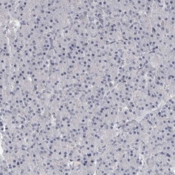DLGAP3 Antibody, Novus Biologicals 0.1mL; Unlabeled:Antibodies, Polyclonal