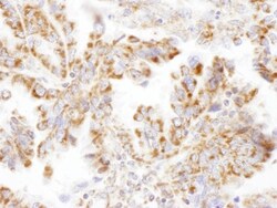 DLST Antibody, Novus Biologicals 0.1mg; Unlabeled:Antibodies, Polyclonal